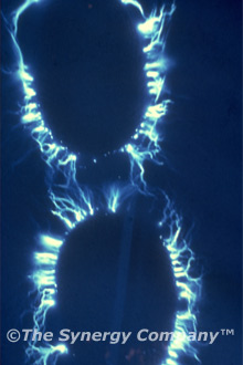 Kirlian Image